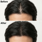 Korean Scalp Revival Bar -