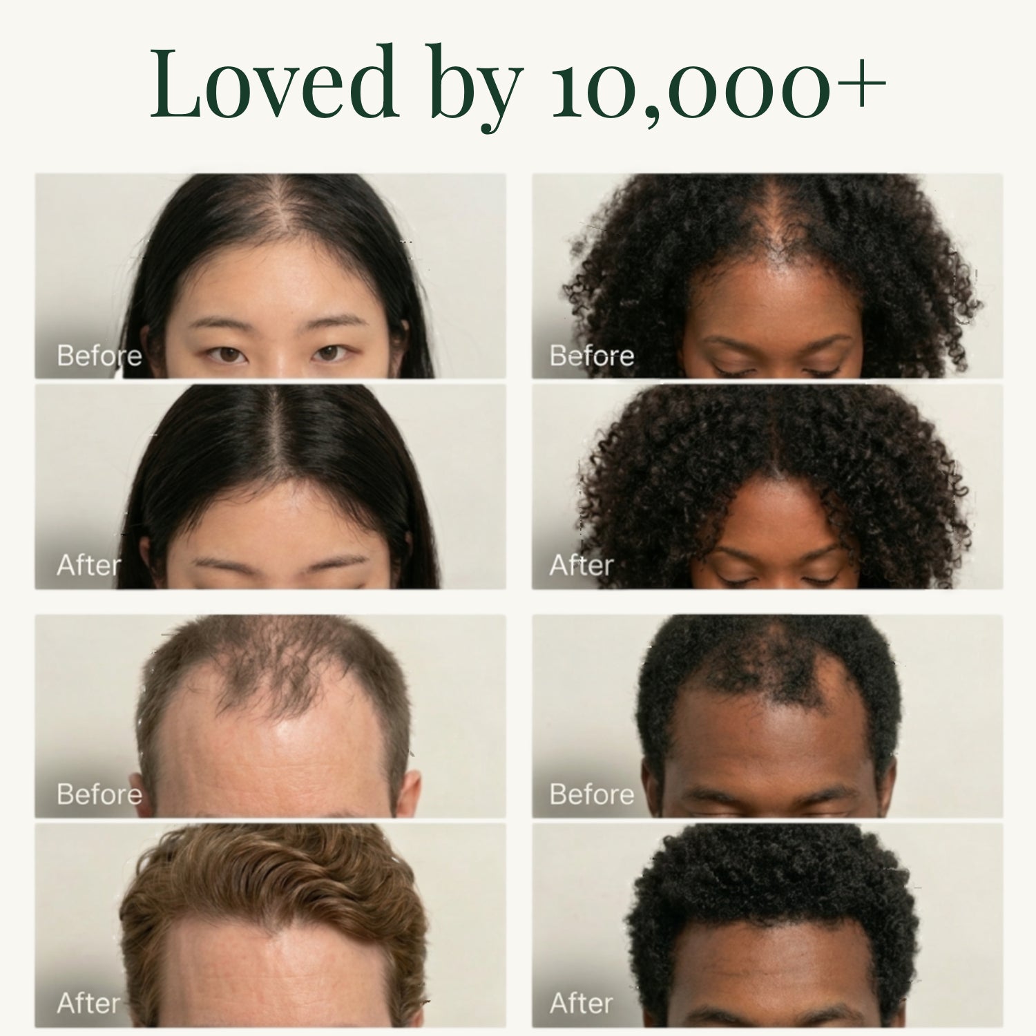 Korean Scalp Revival Bar