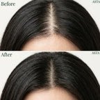 Korean Scalp Revival Bar