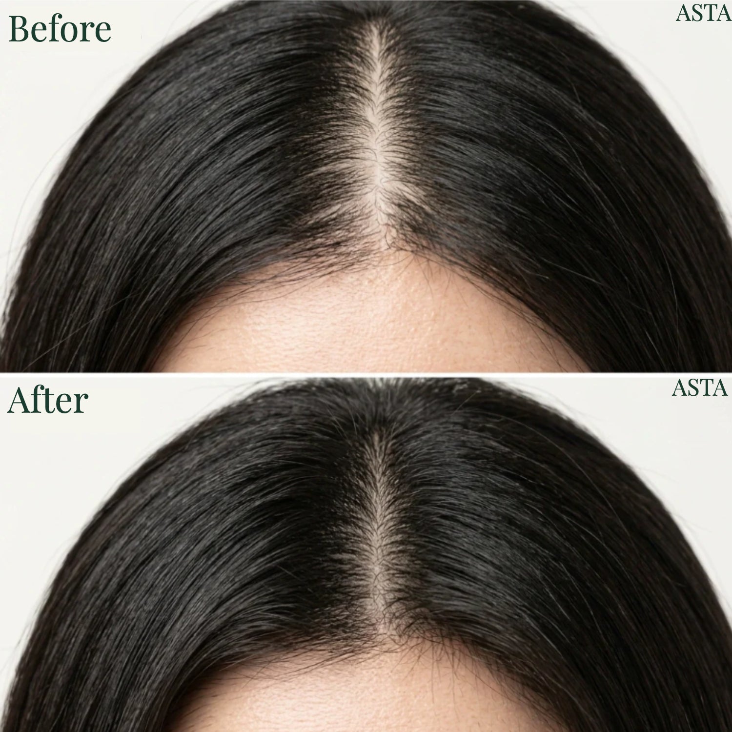Korean Scalp Revival Bar